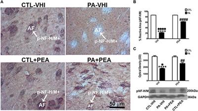 Partial Reversal of Striatal Damage by Palmitoylethanolamide Administration Following Perinatal Asphyxia